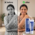 DermaCream — Scar Removal Cream  | Keloid & Stretch Mark Care | Softening & Flattening