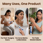 DermaCream — Scar Removal Cream  | Keloid & Stretch Mark Care | Softening & Flattening