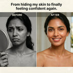DermaCare - Acne/ Tag/ Mole Eraser | Spot Fixers | Clear Invisible Stickers